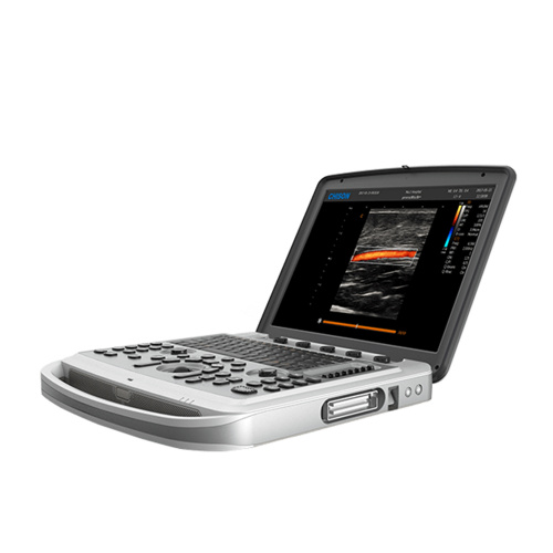 УЗИ аппарат Chison SonoTouch 80 (SonoBook 6)