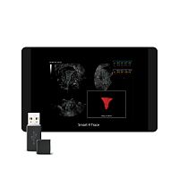 Smart V Trace
