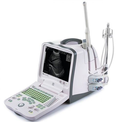 УЗИ аппарат Mindray DP-6900 УЗИ аппарат Mindray DP-6900