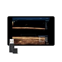 Auto IMT Package
