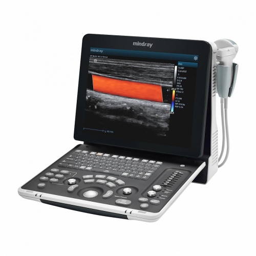 УЗИ сканер Mindray Z60 Exp
