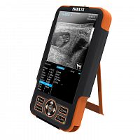 Ветеринарный УЗИ сканер SIUI CTS-800