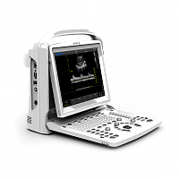 УЗИ аппарат CHISON ECO 3 Expert
