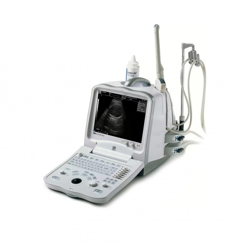УЗИ аппарат Mindray DP 6600